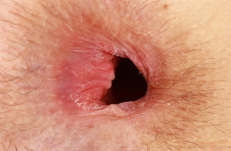 anus beautiful naked img
