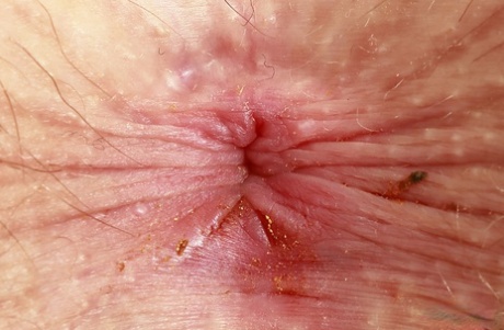 asshole close up free porn photo