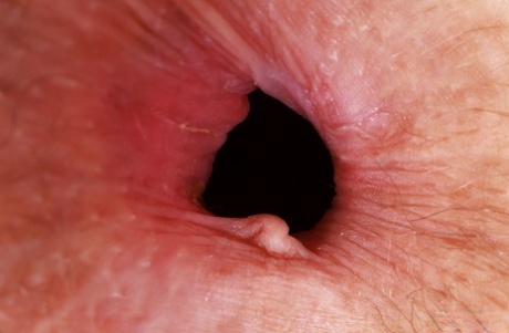 asshole close up nude photo