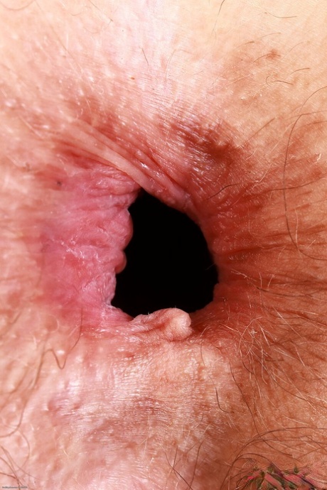 hairy asshole naked archive
