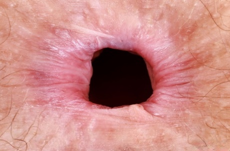 dilatazione anale xxx bellissimo foto