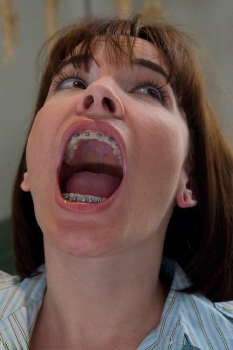 teen braces beautiful pic